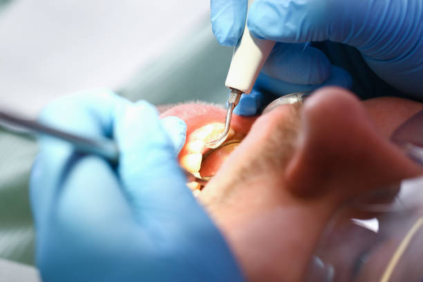 Best Orthodontic Emergency Dentist in Hinsdale, IL
